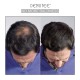 Poudre à Cheveux Densitee - Solution contre la chute des cheveux - 28g